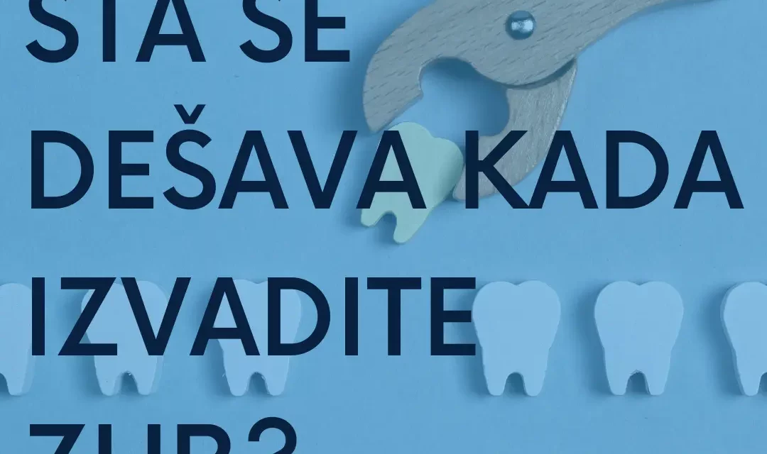 Najbolji zubni implanti – Šta se dešava kada izvadite zub?